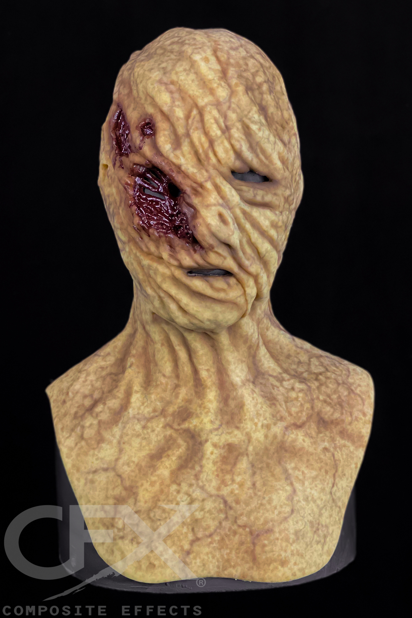 Typhoid-Mary-Jaundice-1.jpg