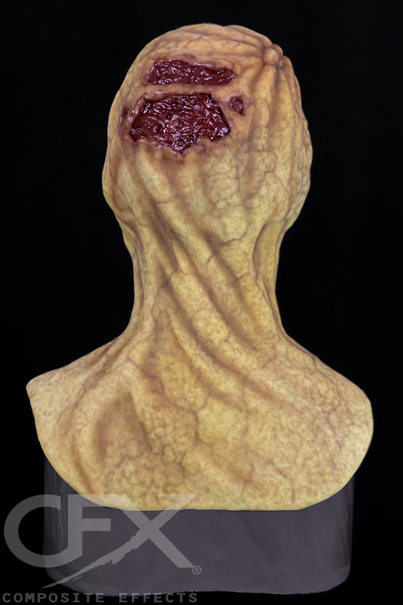 Typhoid-Mary-Jaundice-5.jpg