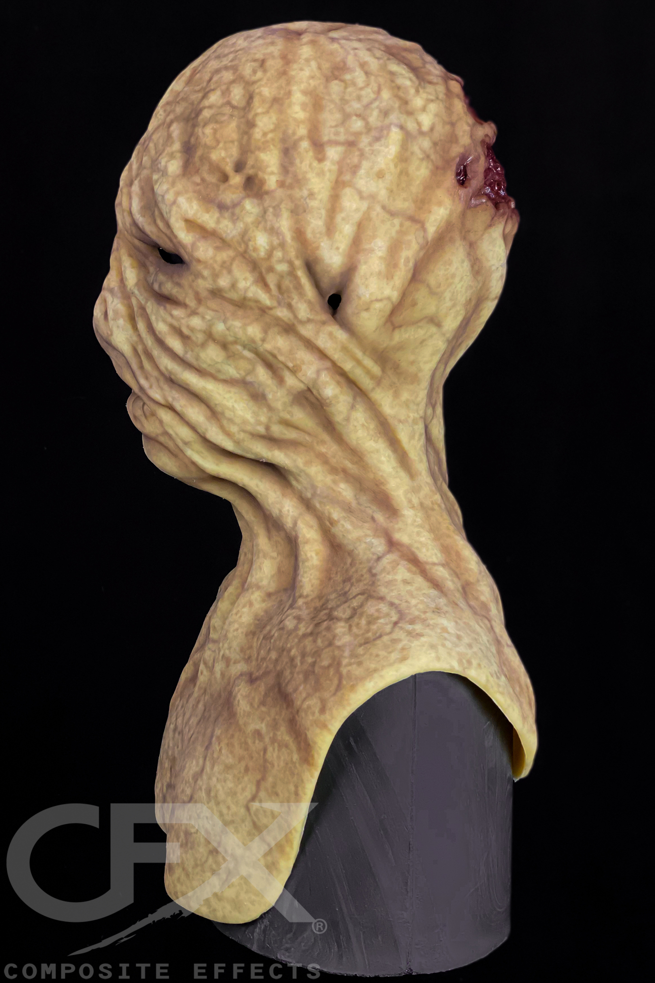 Typhoid-Mary-Jaundice-7.jpg