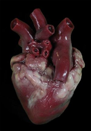 gib_heart_02.jpg https://rhinowebllc.com/cfx-masks2/wp-content/uploads/2024/07/gib_heart_02-300x432.jpg