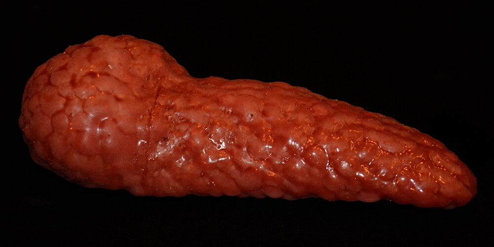 pancreas1.jpg